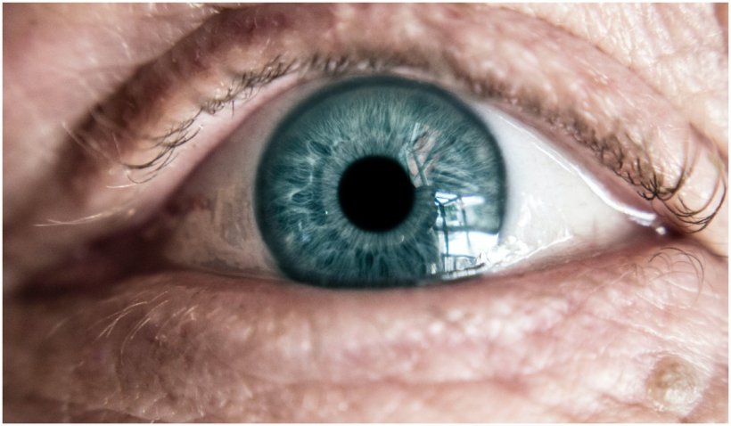 Primul om din lume care a primit o proteză de ochi imprimată 3D este din Marea Britanie - proteza-1637860809.jpg