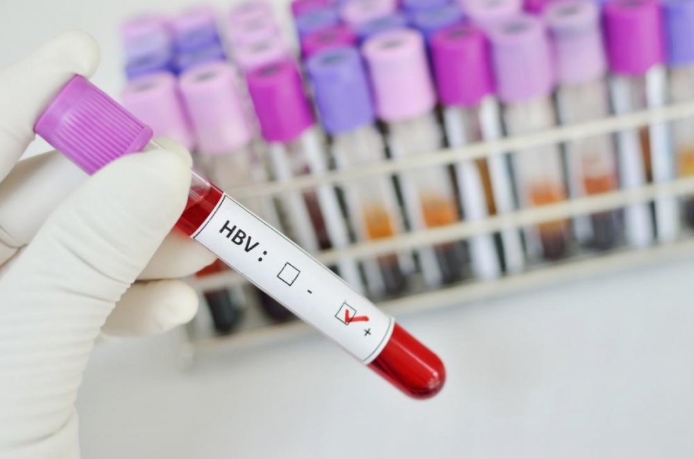Săptămâna testării voluntare pentru HIV, hepatitele B și C - saptamanatestarii-1543220771.jpg