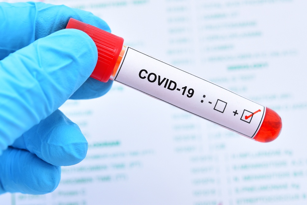 Coronavirus la Constanța. Până în prezent, 2.213 persoane au fost confirmate cu COVID - shutterstock16681187981-1600359326.jpg