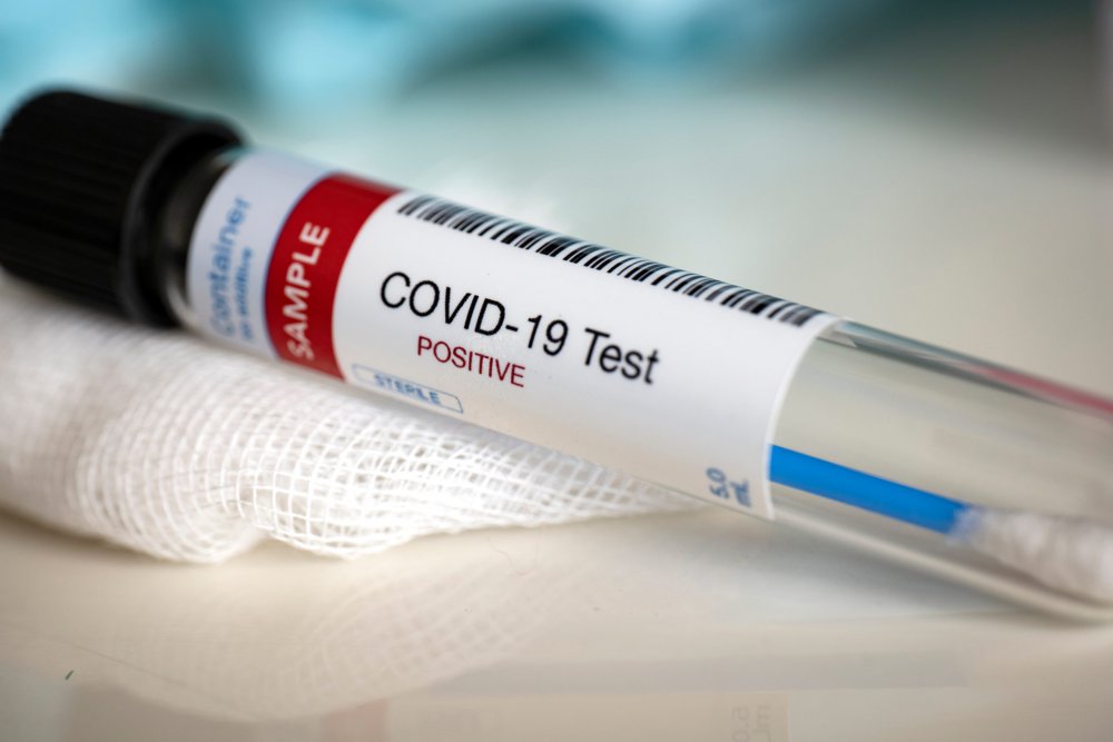 Coronavirus la Constanța. Aproape o sută de cadre didactice, infectate cu SARS-COV-2 - shutterstock1673330692scaled-1604165199.jpg