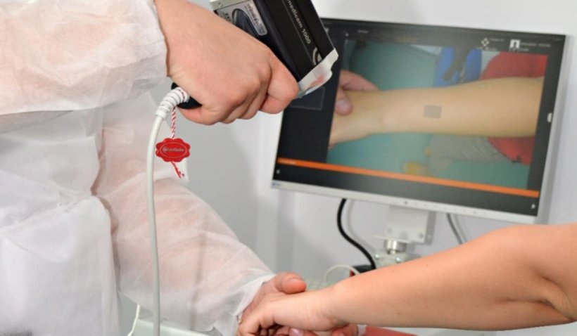 Spital din Galați, dotat cu un aparat unic în România care descoperă cancerul de piele - spital-1649857241.jpg