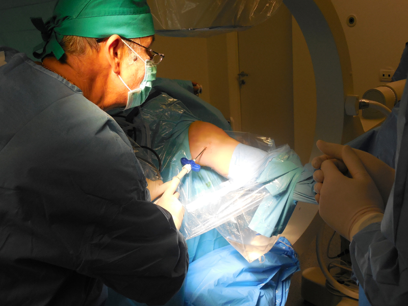 Subcondroplastia - o nouă procedură minim invazivă pentru tratarea pacienților cu dureri de genunchi - subcondroplastia-1417194577.jpg