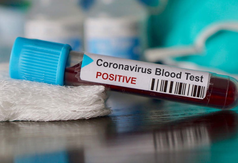 Coronavirus România: 187 de cazuri noi de coronavirus în ultimele 24 de ore - test-1591437966.jpg