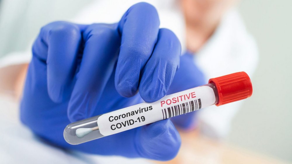 Coronavirus România, bilanț 17 iunie: 87 cazuri noi de persoane infectate cu SARS–CoV–2 - test-1623929817.jpg