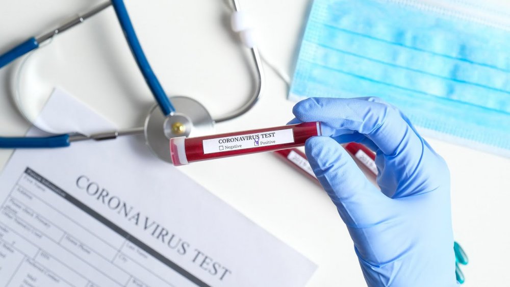 Coronavirus România. Aproape 200 de cazuri noi în București. Județul cu zero infectări - test2-1598440359.jpg