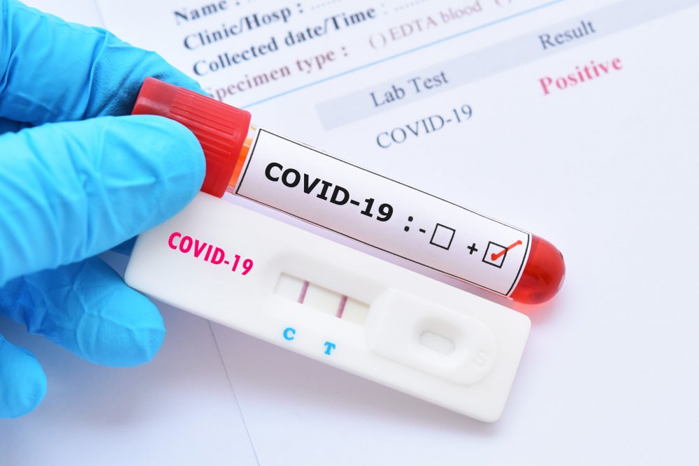 Ministerul Sănătăţii: Aproape 10.000 de cazuri noi de COVID. Constanţa, loc fruntaş la numărul de îmbolnăviri - testcovid19shutterstock169237076-1658916308.jpg