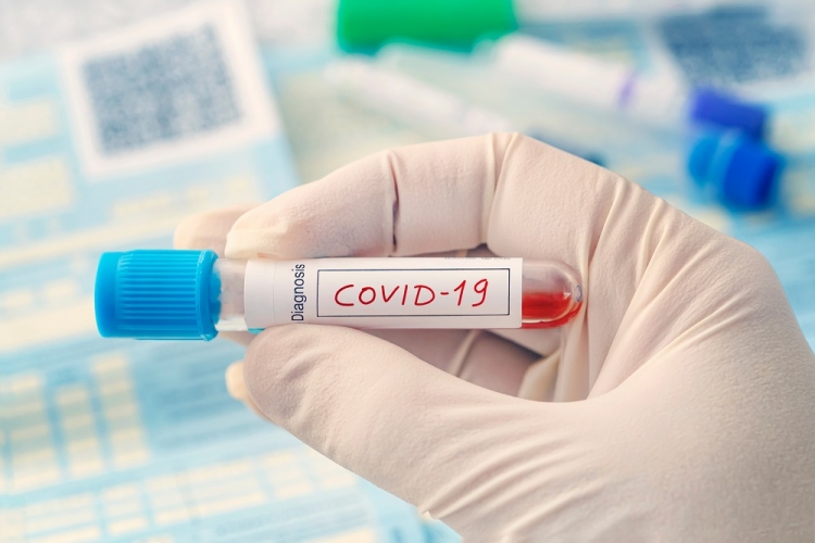 COVID-19. Începe să crească numărul infectărilor zilnice - testcovidcoronavirus3-1609847499.jpg