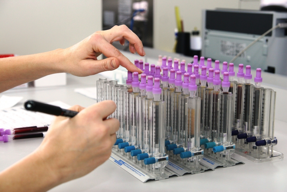 7000 de constănțeni și tulceni testați pentru HIV și hepatită de Fundația Baylor - teste-1369306519.jpg