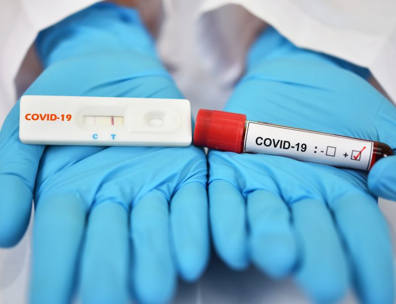 Avertisment: Nu cumpărați teste de imunitate pentru COVID-19 de pe internet! - teste-1588491906.jpg