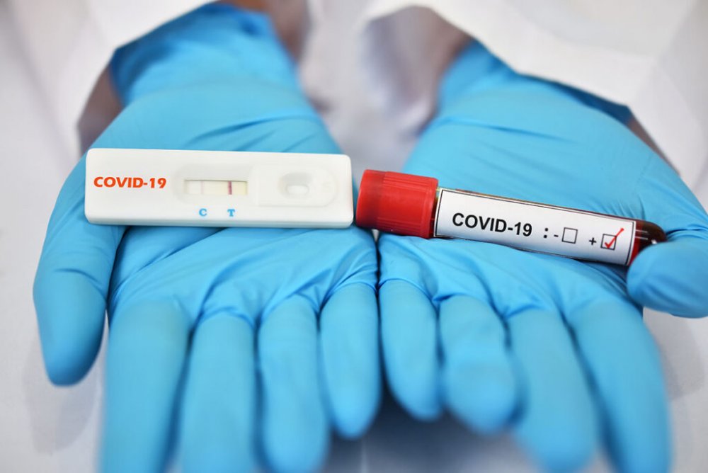 Alte aproape 4000 cazuri noi de Covid, confirmate! Constanţa, fruntaşă la noi îmbolnăviri - testerapidecovid19centrulexcelen-1657794799.jpg