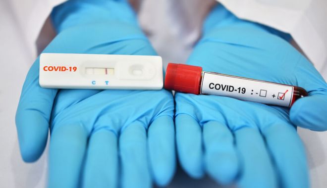 Coronavirus în România. Încă o zi cu multe îmbolnăviri noi. Ce spune Ministerul Sănătăţii - testerapidecovid19centrulexcelen-1663325291.jpg