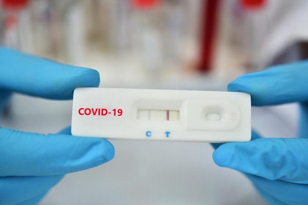 Ministerul Sănătăţii, anunţul zilei. Câte cazuri noi de Covid au fost înregistrate, în ultimele 24 de ore - testrapidantigencovid19600x400c-1660651114.jpg