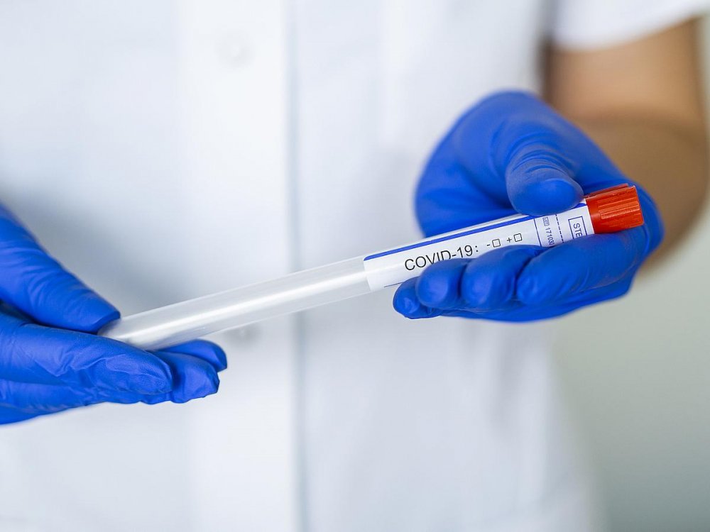 Bucureștenii se testează împotriva noului coronavirus - virus-1590392159.jpg