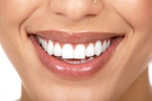 Lăsați-o mai moale cu albitul dinților! - whiteteethsmile300x199-1351548310.jpg