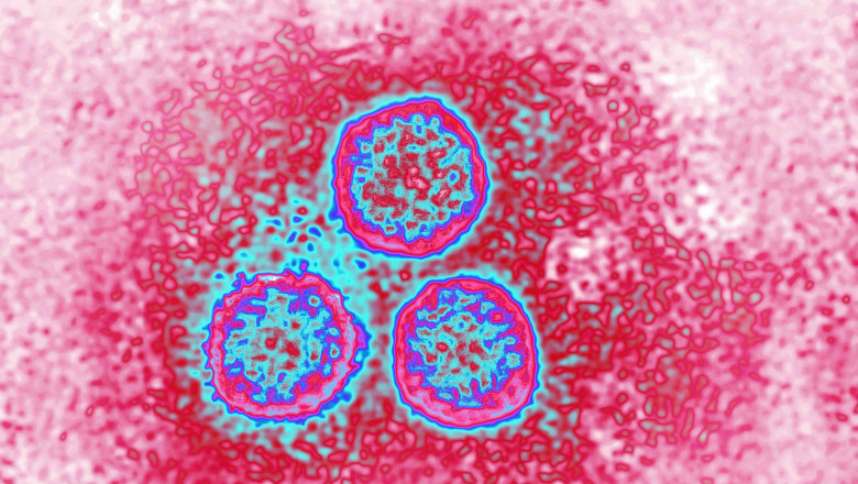 Cercetătorii atrag atenția! 1 din 3 bărbaţi din întreaga lume este infectat cu virusul HPV - yzcxotlinzg5zgq4mzy1yzdkodu4njew-1694346908.jpg